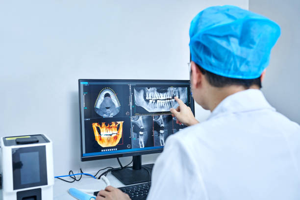 Best Emergency Tooth Extraction in Hendersonville, TN